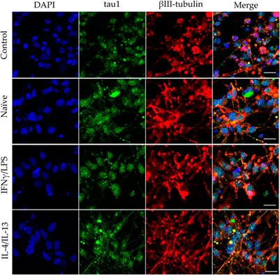 Microglia modulate proliferation, neurite generation and differentiation of human neural progenitor cells